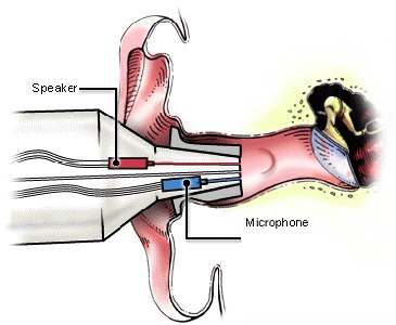 Sonda per otoemissioni